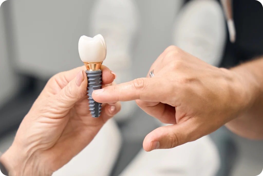 Implant dentaire