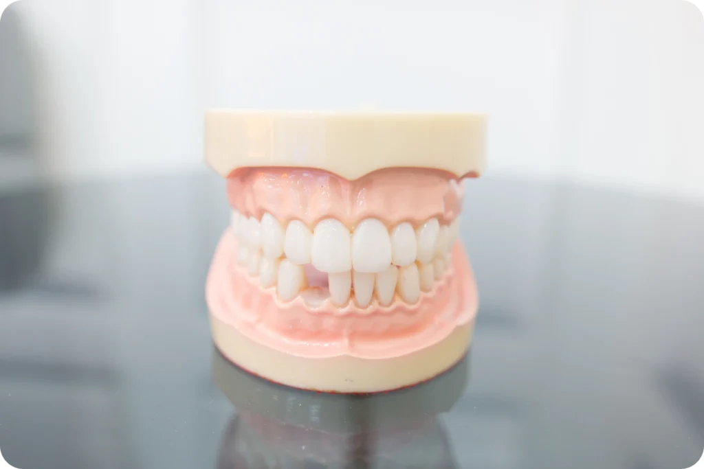 Modèle anatomique d'une mâchoire avec dents