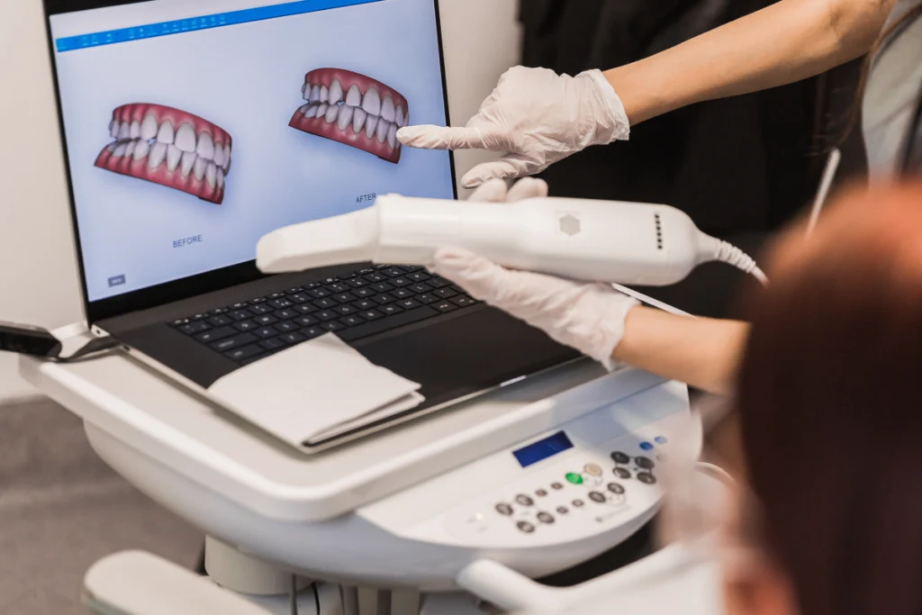 Empreinte numérique 3D affichée à l'écran, praticien au travail