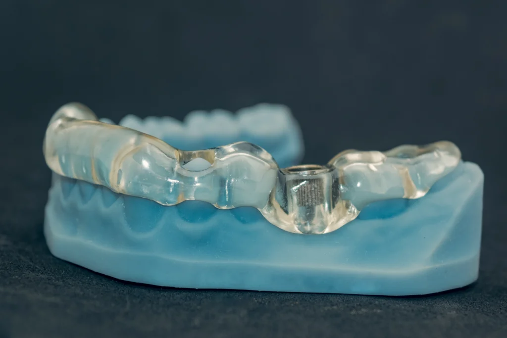 Guide chirurgical utilisé pour une chirurgie implantaire guidée