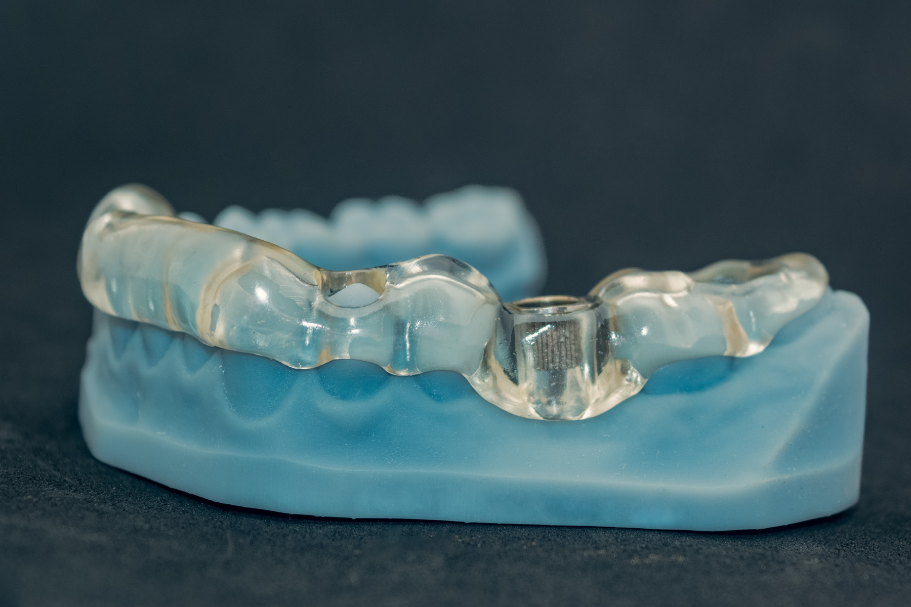 Guide chirurgical utilisé pour une chirurgie implantaire guidée