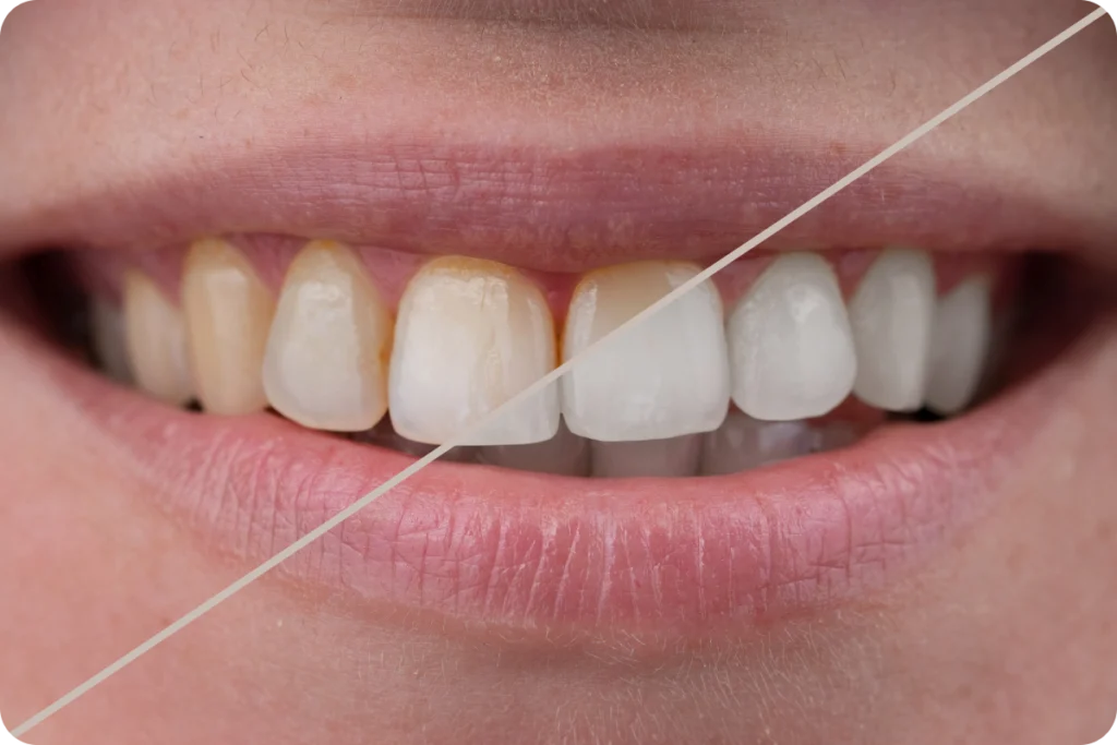Gros plan sur un sourire aux dents blanches