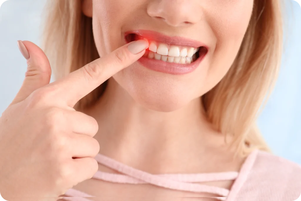 Femme montrant sa gencive du doigt, sourire