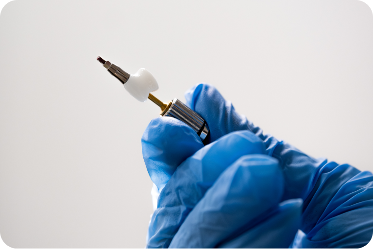 Main gantée tenant un implant dentaire monté sur son porte-implant